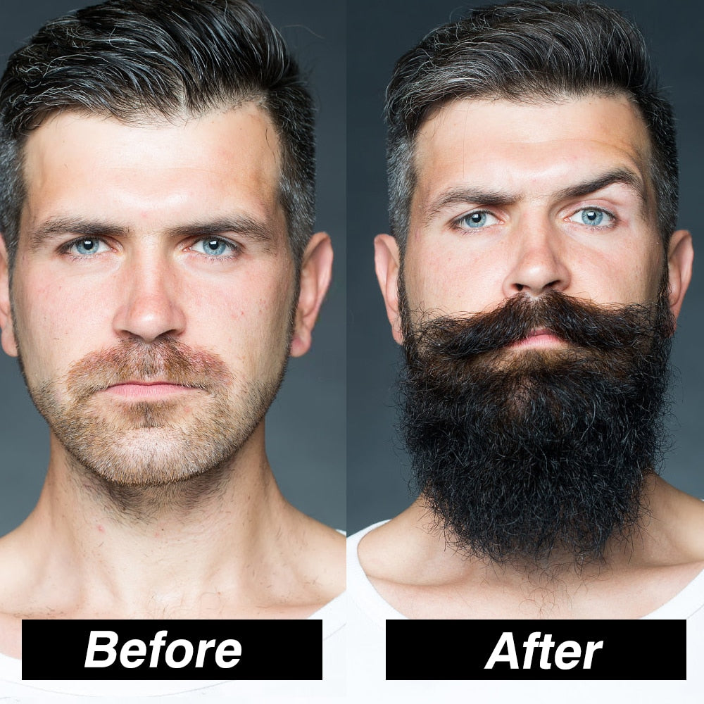 Men Beard Growth Kit